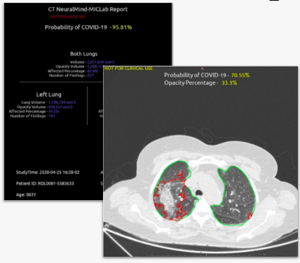 Projeto Detecção de Covid-19